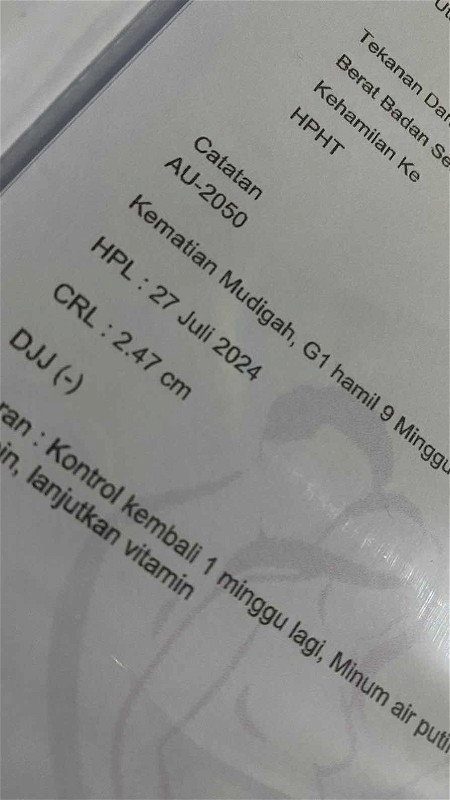 Suami ke luar kota aku kontrol sendirian