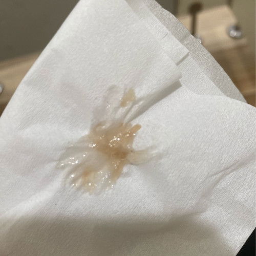 ตกขาวหรือมูกอะไร