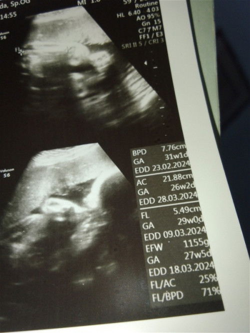 hasil usg🙂