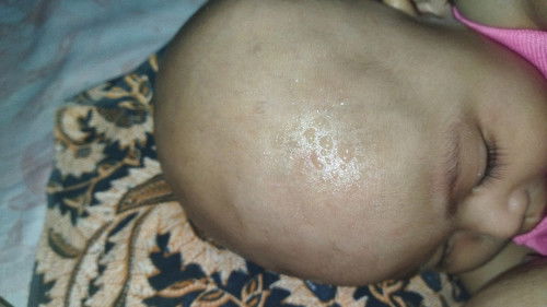 Bayi keringat berlebih