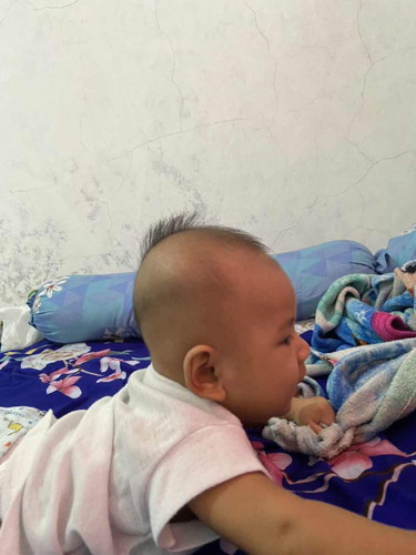 Kepala bayi
