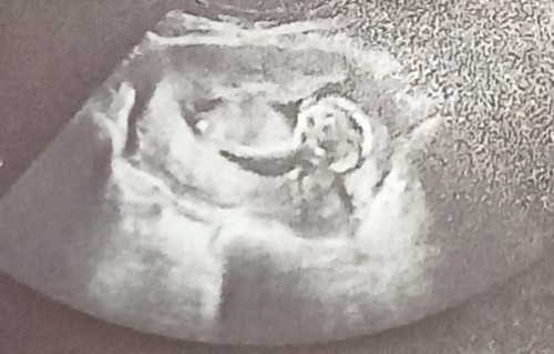 Boy or Girl?