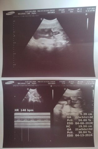 22weeks Ultrasound