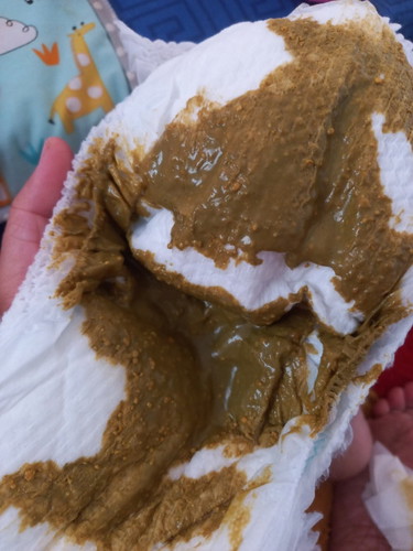 Bab bayi lactogen normal ga? Bru gnti aja