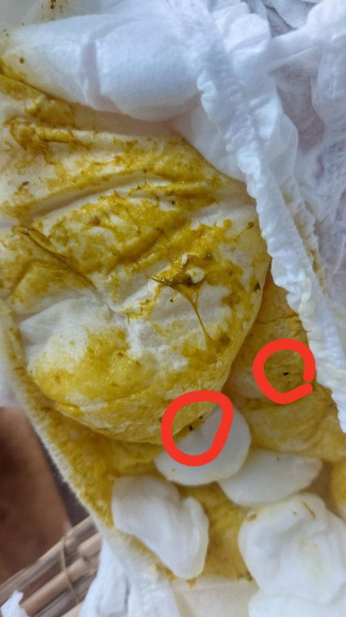 ลูก 4 เดือน ถ่ายปกติหรือไม่