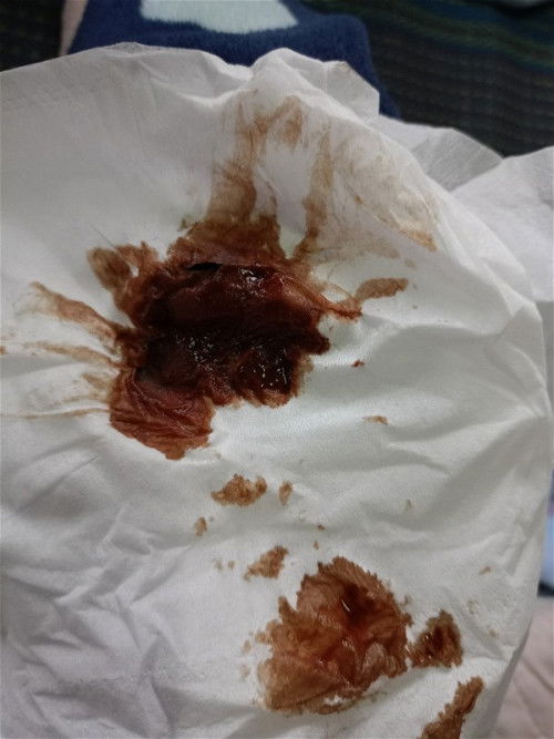 กลัวมากๆเลยค่ะแม่ๆคนไหนรู้บอกทีนะคะ