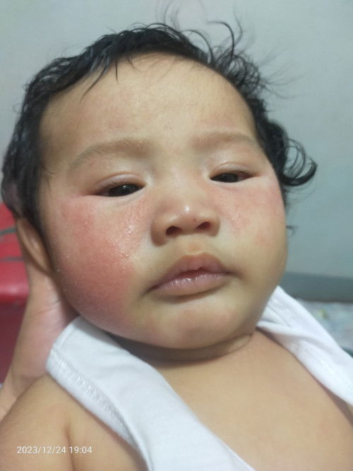 Nagkaganito rin ba baby nyo mga mommies? simula ng 2 1/2 mnths si baby