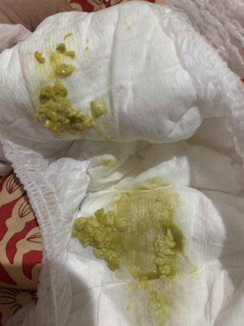 ขี้แบบนี้ปกติมั้ยค่ะ