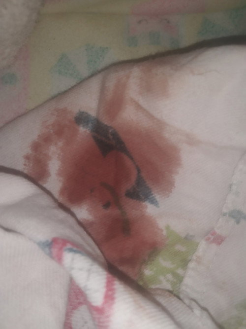 Dinugo 10 weeks pregnant