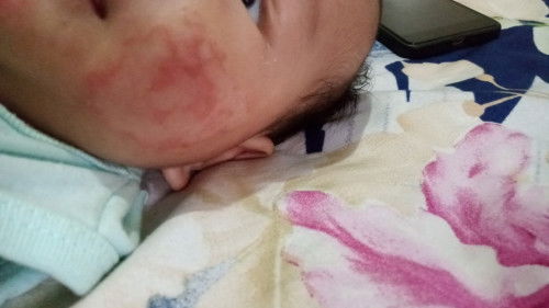 Rekomend cream ampuh