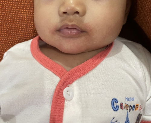 Kawasan mulut kemerahan