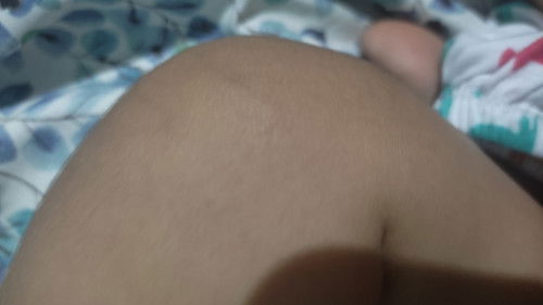 Ano po ito sa balat niya