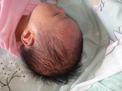 bun mau tanya kalau kepala bayi seperti ini kenapa ya?