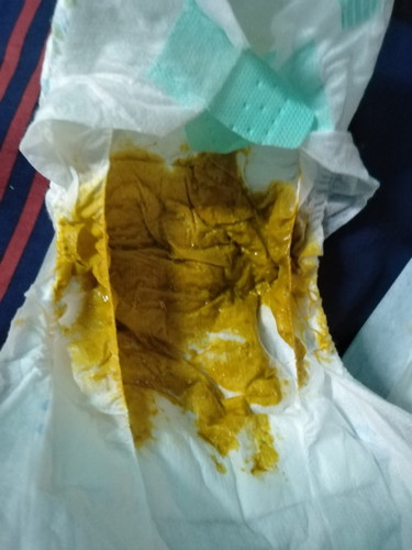 น้องถ่ายเยอะและมีกลิ่น