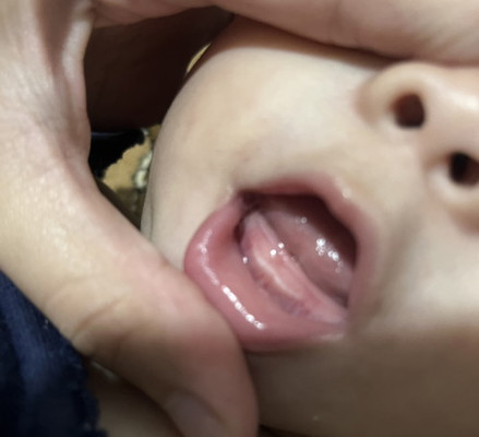 gigi bayi 7bulan