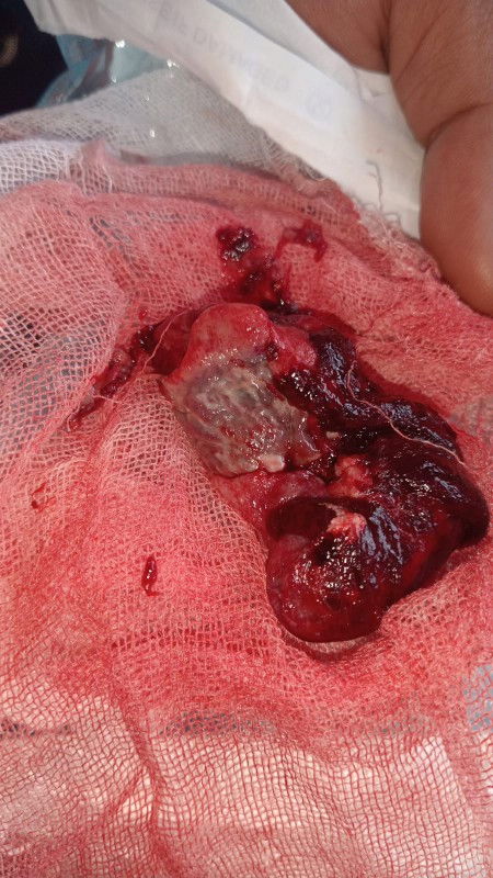 Ijin undur diri bund dari grup hpl juli 2024 aku keguguran di usia janin 10 minggu😭