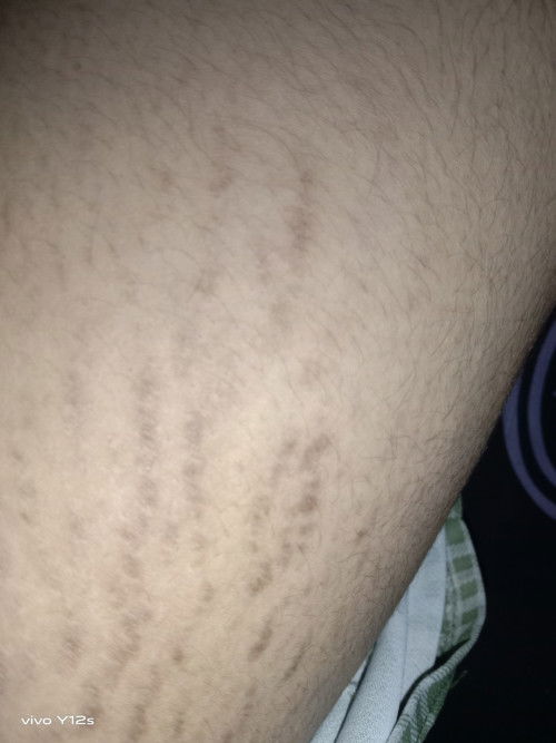 Bunda bunda barangkali