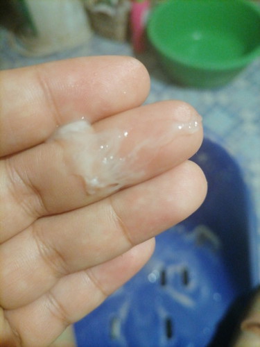 36+2อยากทราบว่าเป็นมูกหรือตกขาว