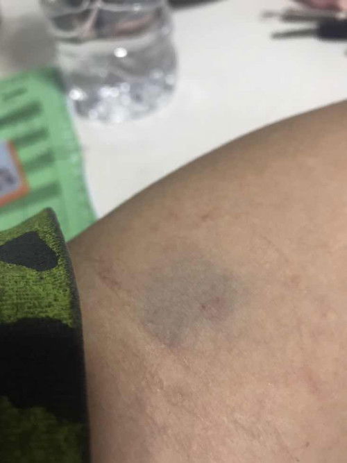 กินยาพารา3เม็ดจะส่งผลอะไรต่อลูกมั้ยคะ