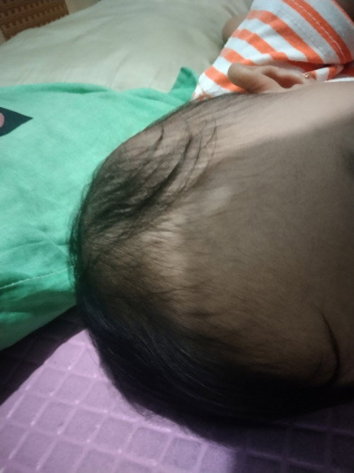 apakah ini bisa di sebut ciri" dehidrasi?
