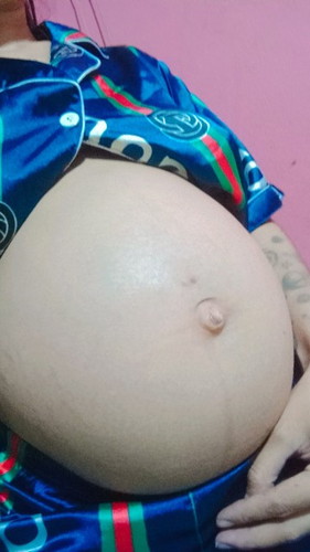 21W 5d ท้องเล็กไปรึป่าวคะ ขอคำปรึกษาหน่อยค่ะ