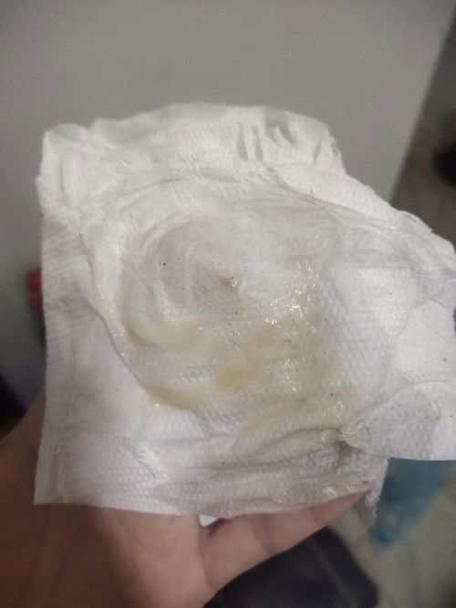 สอบถามแม่ๆค่ะ