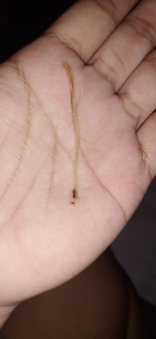 hello FTM po tanong lang po kung normal lang ba labasan ng ganito 10 weeks pregnant po .. salamat po