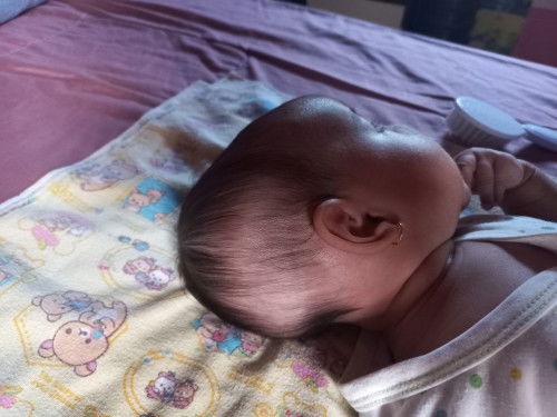 Rambut bayi rontok