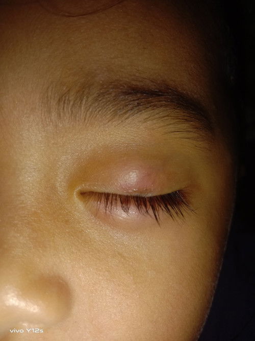 Assalamu'alaikum bundh sya izin bertnya