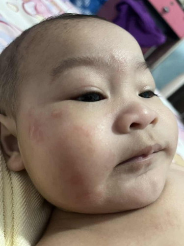 หน้าน้องเป็นแบบนี้