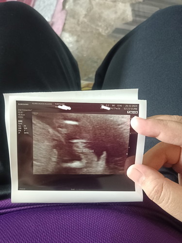 Gender baby