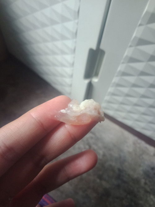 Maaf jorok,apa keluar lendir seperti ini tanda mau melahirkan,soal nya tadi gax sengaja ketendang