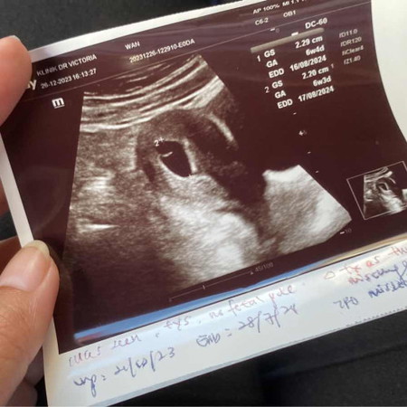 2kali scan tak nampak baby😭