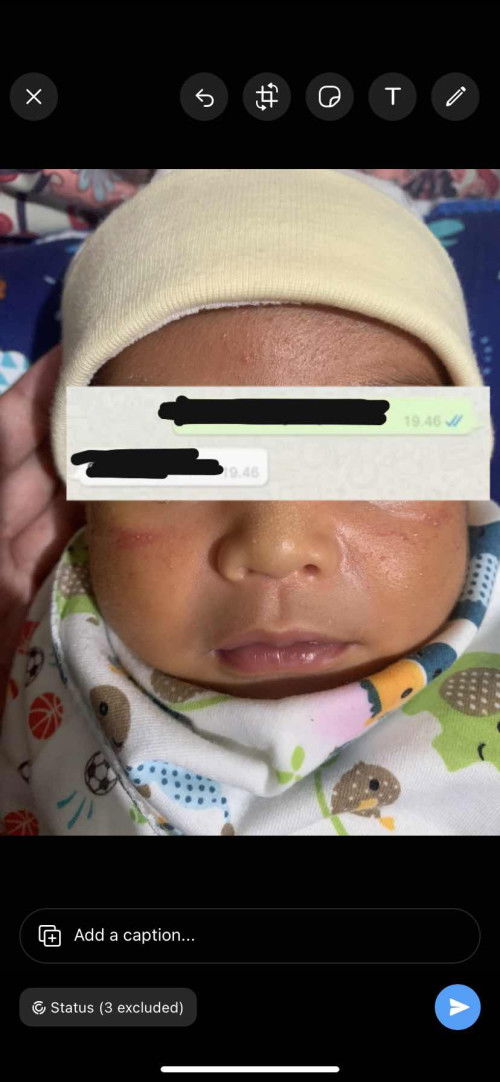 Bintik merah di pipi