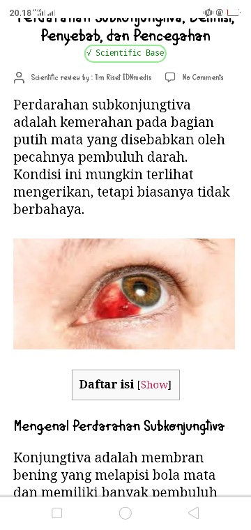 Mata anaku bercak merah