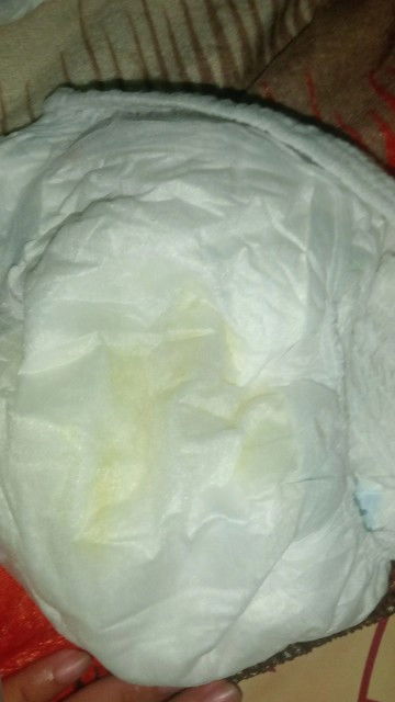 Warna urin dehidrasi