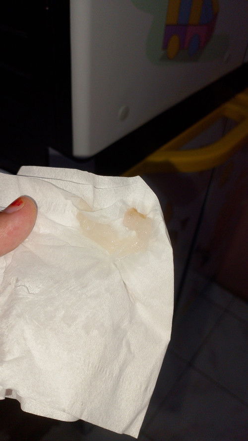 Bund mau tanya dong.. Aku keluar spt ini.. Ini ketuban atau keputihan ya.. Hpl ku tgl 25 kmaren