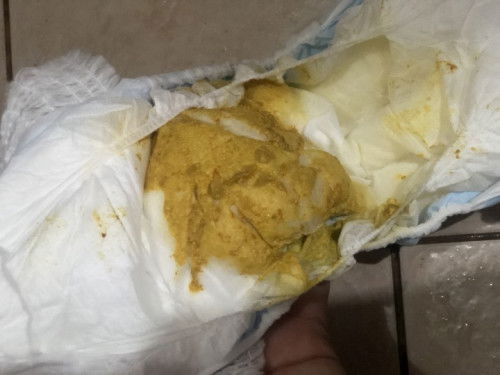 baby poop, 4times na sya nagpoop ngaun buong araw. start nung 25 ng morning