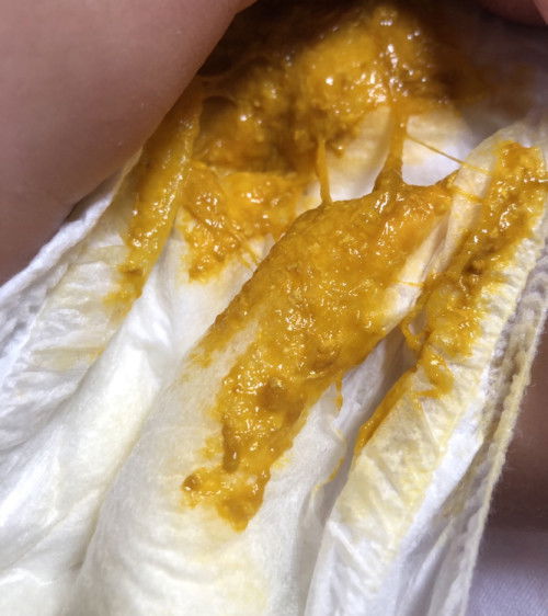 Diare tak kunjung sembuh