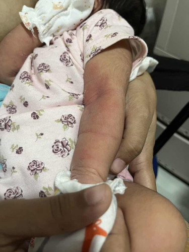 Hi! May nkaexperience na po ba nito sa mga LO niyo? Ano po kaya ito? 1 week old baby