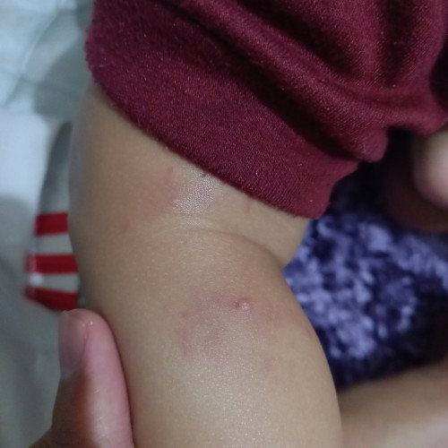 Rekomendasi salep / obat untuk iritasi kulit bayi 7 bulan