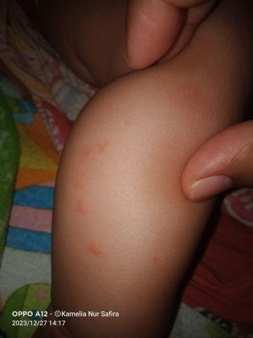 Ada yang tau gak ini kenapa mom ada yang tau ga obat nya pake apa