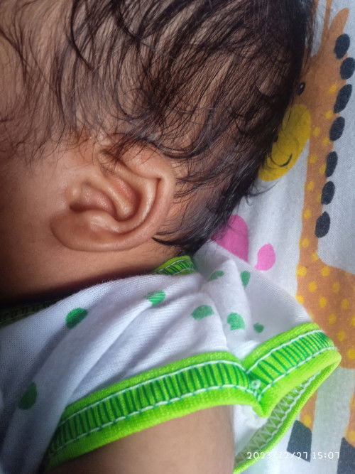 Daun telinga bayi nekuk