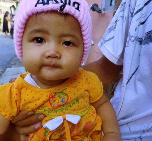 Sharing bun mata terlihat sipit sebelah