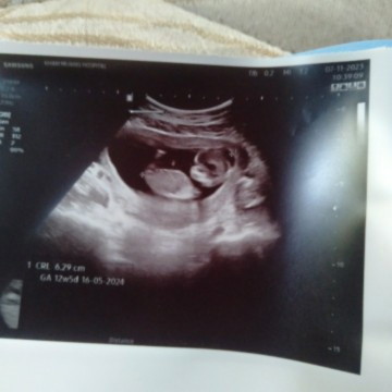 หญิงหรือชายค่ะแม่ๆ