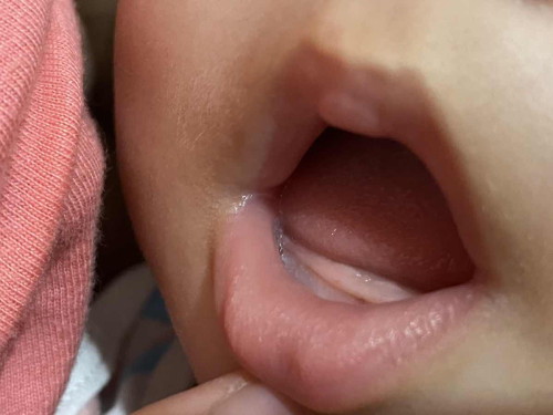 Teething 4 months old