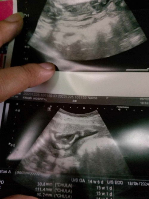 ช่วยดูช่วยคอมเม้นหน่อยจ้า🤣