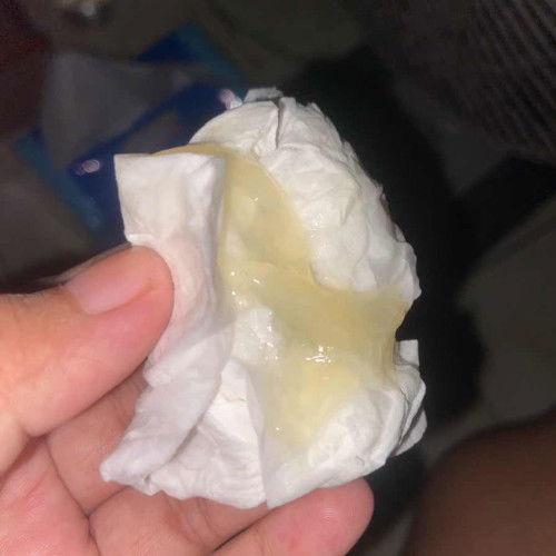 Cairan seperti jelly