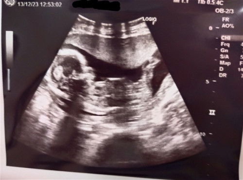 ดูเพศยังไงคะ