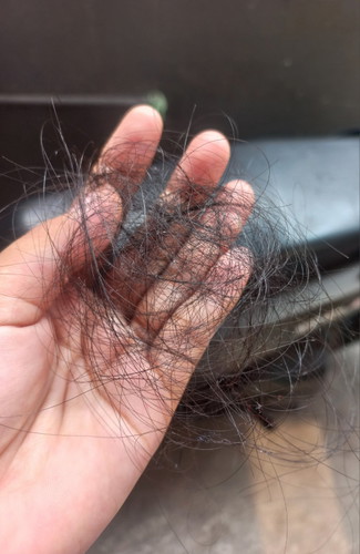 hpl agustus lagi rontok rontoknya sampai botak😭😭😭